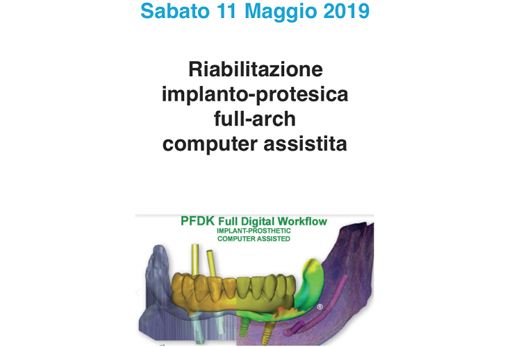 Riabilitazione Implanto-protesica Full-arch, Computer Assistita Riabilitazione Implanto-protesica Full-arch, Computer Assistita