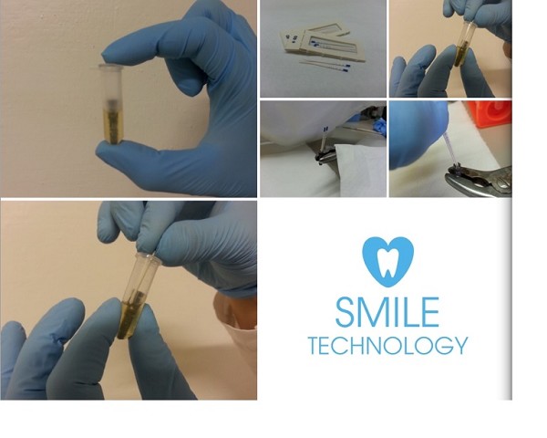 Silver-chlorexidine-liquid is effective to sterilize screw retaining abutment to implant space...