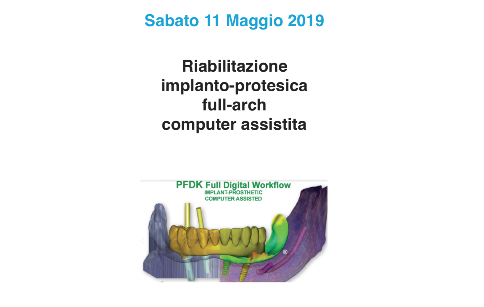 Riabilitazione Implanto-protesica Full-arch, Computer Assistita